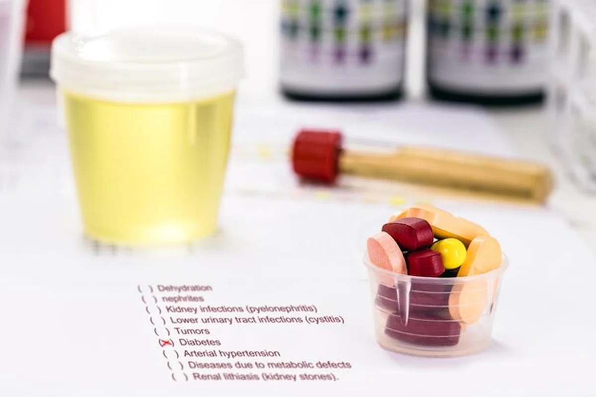 Badanie lekarskie z butelką moczem i tabletkami na cukier we krwi